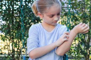 Účinnost a bezpečnost dupilumabu se současně podávanými topickými kortikosteroidy u dětí ve věku od 6 do 11 let s těžkou formou atopické dermatitidy: randomizovaná, dvojitě zaslepená, placebem kontrolovaná studie fáze III