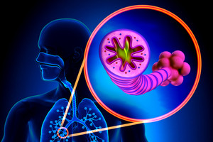Současné chápání patogeneze astmatu a role biomarkerů